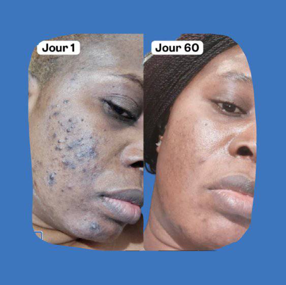 Éclat Naturel : Découvrez les Bienfaits du Gommage – Guide 2026