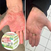 Dermapli Crème 80g – soin douceur et confort