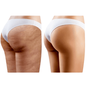 Pack Fessier Complet 5 produits - nilabeautys.com